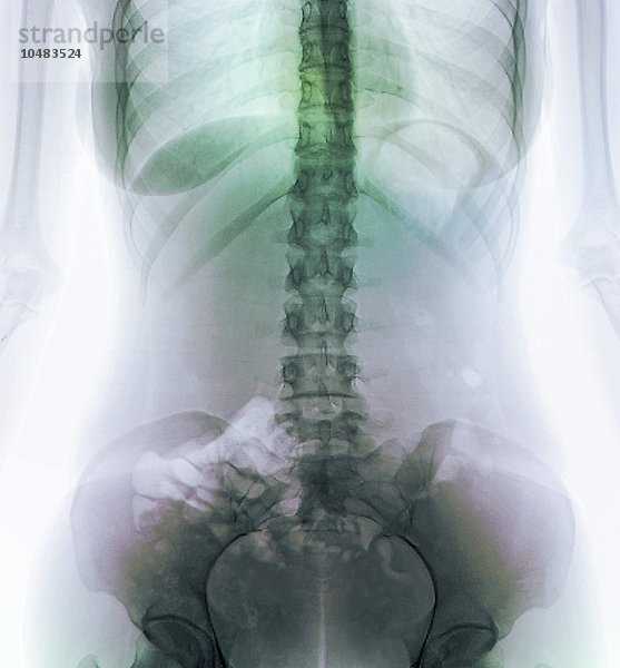 Normaler Unterleib. Farbiges Röntgenbild des Abdomens einer 20-jährigen Frau  normales Abdomen  Röntgenbild