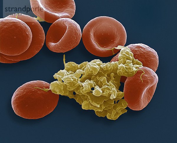 Blutzellen. Farbige rasterelektronenmikroskopische Aufnahme (SEM) von roten Blutkörperchen und einer Ansammlung von Blutplättchen (gelb). Vergrößerung: x4000 bei einem Druck von 10 Zentimetern Breite Blutzellen  SEM