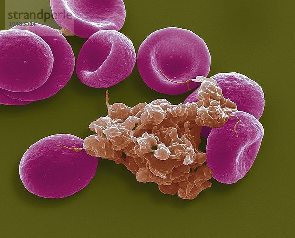 Blutzellen. Farbige rasterelektronenmikroskopische Aufnahme (SEM) von roten Blutkörperchen (rosa) und einer Ansammlung von Blutplättchen (rot). Vergrößerung: x4000 bei einem Druck von 10 Zentimetern Breite Blutzellen  SEM