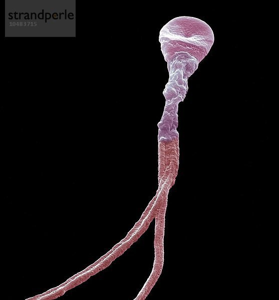 Deformierte Samenzelle. Farbige rasterelektronenmikroskopische Aufnahme (SEM) einer Spermazelle mit mehreren Schwänzen. Vergrößerung: x5000 bei einer Druckbreite von 10 Zentimetern Deformierte Samenzelle  SEM