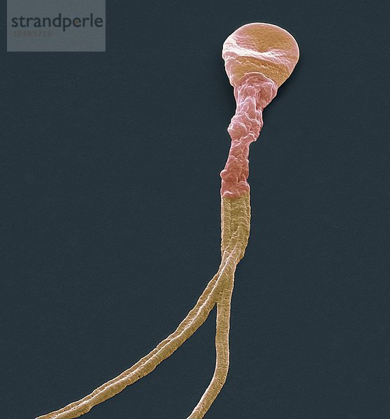 Deformierte Samenzelle. Farbige rasterelektronenmikroskopische Aufnahme (SEM) einer Spermazelle mit mehreren Schwänzen. Vergrößerung: x5000 bei einer Druckbreite von 10 Zentimetern Deformierte Samenzelle  SEM