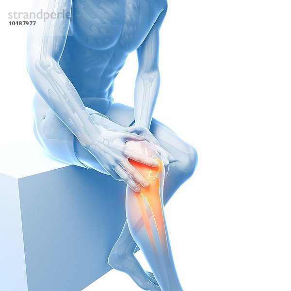Schmerzhaftes Knie  Computer Kunstwerk Schmerzhaftes Knie  Kunstwerk