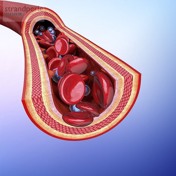 Menschliche Arterie  ausgeschnittene Computergrafik Menschliche Arterie  Kunstwerk