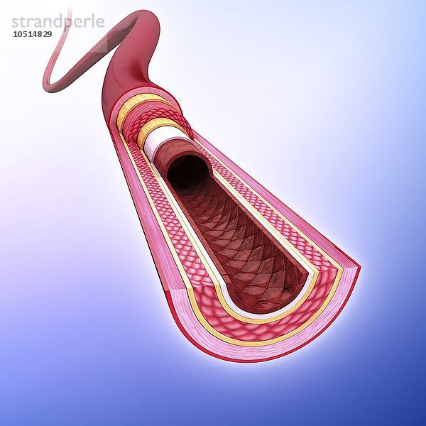 Menschliche Arterie  ausgeschnittene Computergrafik Menschliche Arterie  Kunstwerk