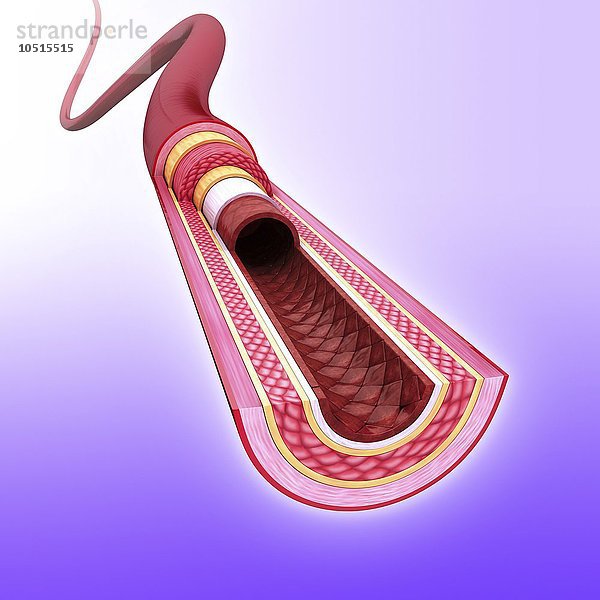 Menschliche Arterie  ausgeschnittene Computergrafik Menschliche Arterie  Kunstwerk