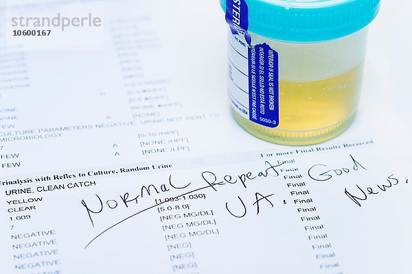 Studioaufnahme der Urinprobe auf einem Testausdruck mit normalen Ergebnissen. Die Tests werden im Rahmen eines jährlichen Gesundheitschecks durchgeführt.