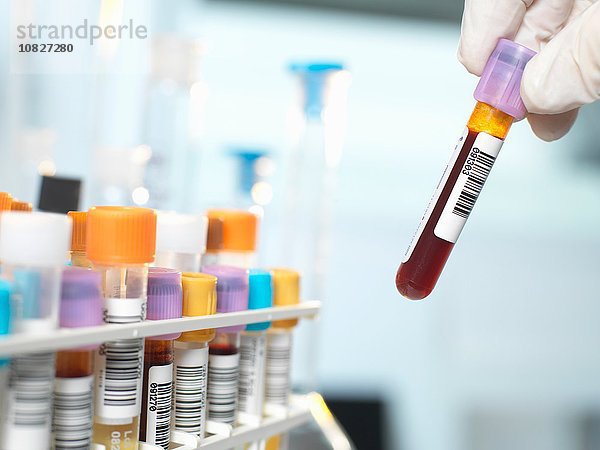 Labortechniker bei der Vorbereitung der Blutprobe für die medizinische Untersuchung im Labor