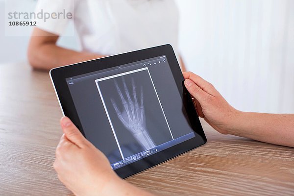 Frau hält digitales Tablett mit Röntgenbild der Hand auf dem Bildschirm