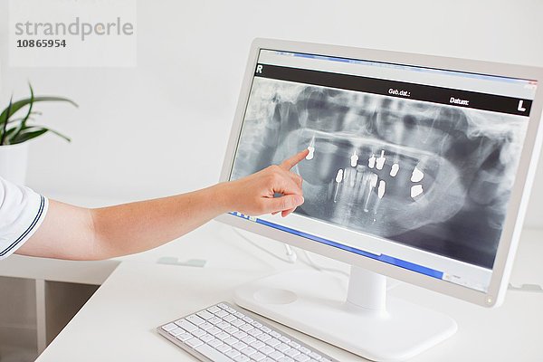 Person  die auf ein Röntgenbild auf einem Computerbildschirm zeigt