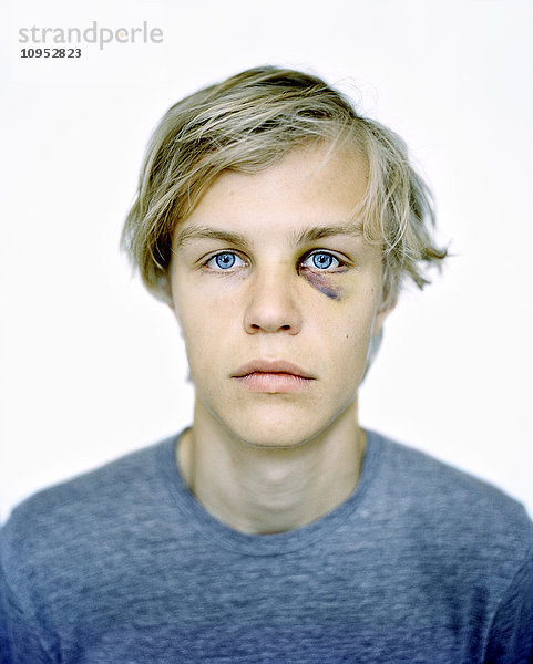 Porträt eines Jungen mit blauem Auge
