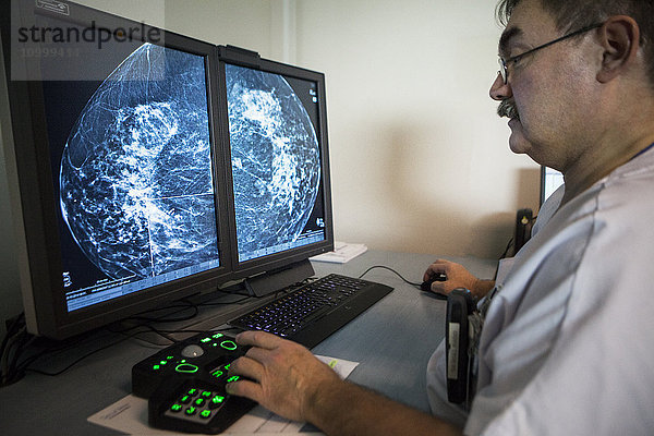 Reportage in einem radiologischen Dienst in einem Krankenhaus in Haute-Savoie  Frankreich. Ein Arzt interpretiert ein verdächtiges Mammogramm.