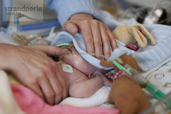 Frühgeborenes auf der Intensivstation eines Kinderkrankenhauses