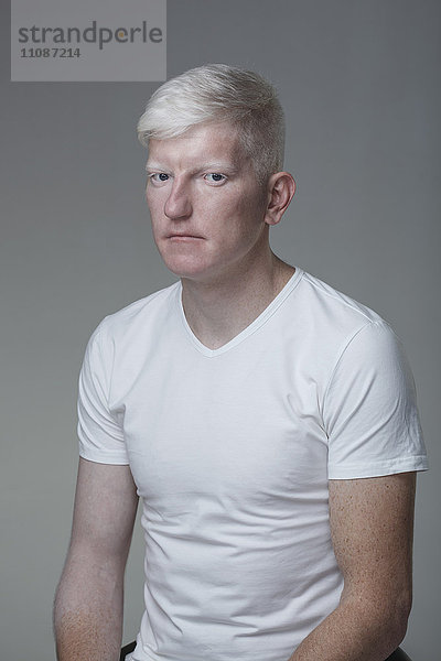 Porträt eines jungen Albino-Mannes auf grauem Hintergrund