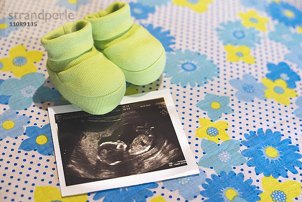 Ultraschall eines Mädchens und winzige Babyschuhe auf einem geblümten Tuch