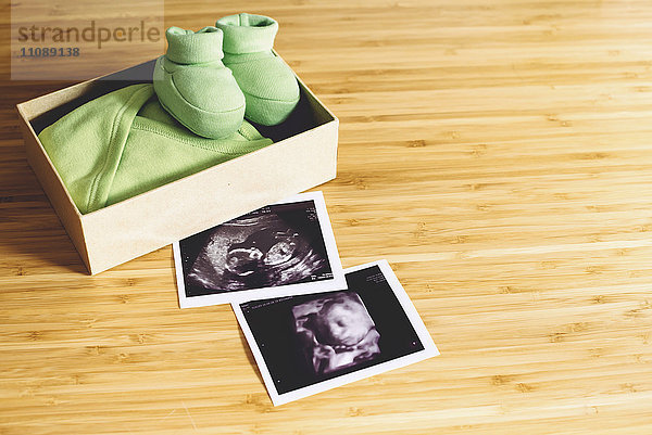 Baby Girl Ultraschall  normal und 4D  neben einem Geschenkkarton mit kleinen Kleidern und Schuhen auf Holz