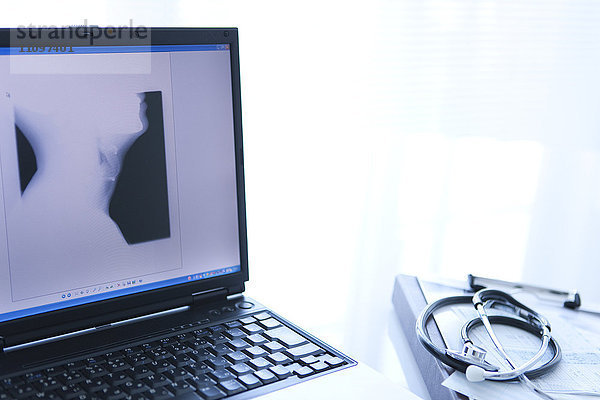 Stethoskop und Röntgenbild auf Laptop