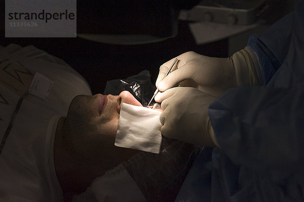 Reportage in der Klinik New Vision in Nizza  Frankreich. Diese Klinik ist eines der wichtigsten Zentren für refraktive Chirurgie in Frankreich und verfügt über modernste Technologie für alle Augenlaseroperationen. Behandlung von Kurzsichtigkeit mit der PRK-Technik (Photorefraktive Keratektomie). Die PRK wird mit dem Excimer-Laser durchgeführt. Sie besteht darin  die Hornhaut neu zu modellieren  indem der Laser direkt auf die Oberfläche des Auges aufgebracht wird  nachdem die oberste Schicht der Hornhaut (Epithel) entfernt wurde. Das Epithel wird mit einer mechanischen Bürste oder mit einer kontrollierten 30-prozentigen Alkohollösung abgetragen.