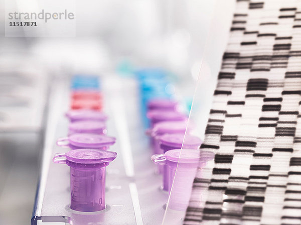 Ein DNA-Autoradiogramm-Gel  das genetische Informationen zeigt  mit Proben in einer Schale
