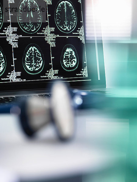 Serie von MRT-Gehirnscans am Computerbildschirm mit Stethoskop im Vordergrund auf dem Arzttisch