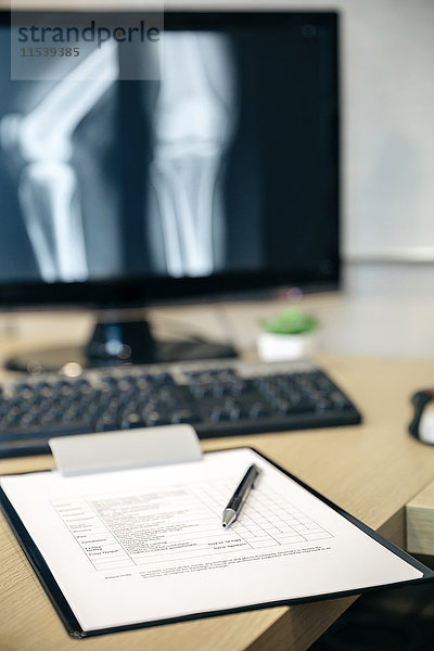 Nahaufnahme des medizinischen Berichts auf dem Tisch und Röntgenbild auf dem Computerbildschirm
