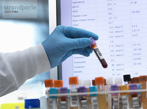 Blutanalyse  Hämatologe bereitet medizinische Proben vor  einschließlich Blut für Tests mit Ergebnissen auf dem Computerbildschirm