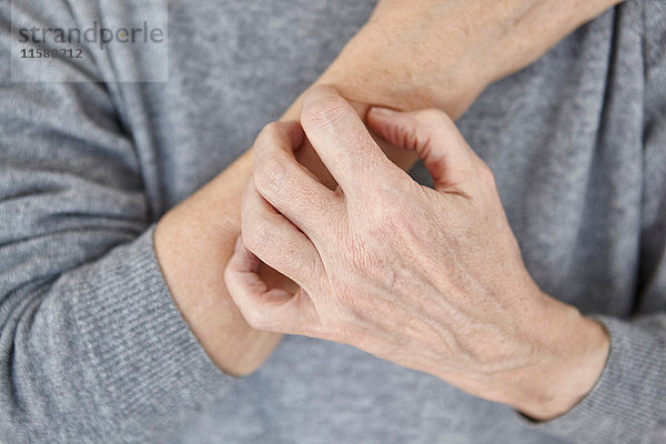 Ältere Frau  die sich am Arm kratzt  Nahaufnahme