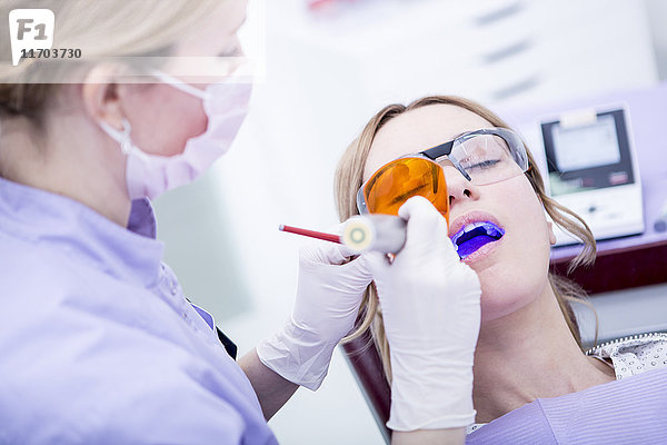 Aushärtung der Zahnfüllung beim Zahnarzt