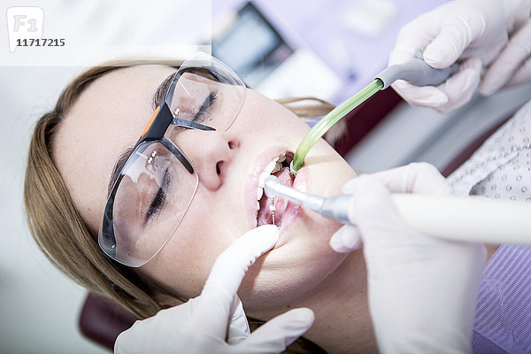 Frau beim Zahnarzt in der Wurzelkanalbehandlung