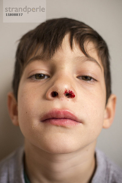 Porträt eines gemischtrassigen Jungen mit blutiger Nase