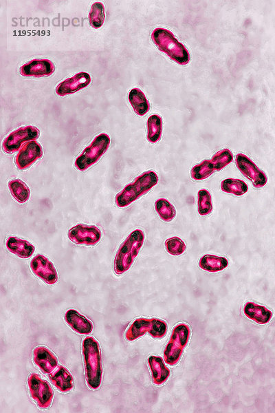 Yersinia pestis (früher Pasteurella pestis). Für die Pest verantwortliches Bakterium. Unter dem Lichtmikroskop gesehen X 1000