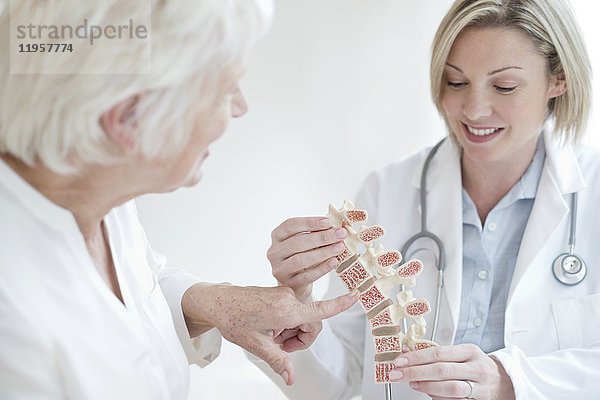 MODELL FREIGEGEBEN. Eine Ärztin zeigt einem Patienten ein anatomisches Modell der menschlichen Wirbelsäule.