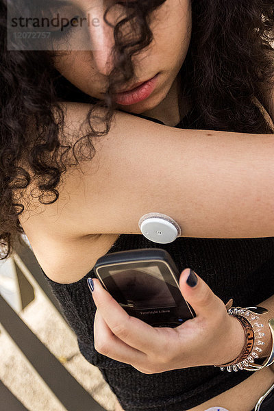 Eine junge Diabetikerin  ausgestattet mit einem Glukosesensor und einem Freestyle Libre Scanner. Der Scanner kann einfach an den Sensor auf der Rückseite des Arms gehalten werden  um den Blutzuckerspiegel sofort zu messen.
