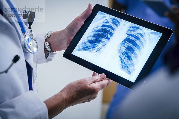 Ärzte untersuchen Röntgenaufnahmen von Brust und Rippen auf einem digitalen Tablet