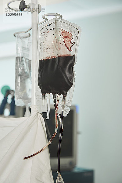 Nahaufnahme des im Krankenhaus hängenden Blutbeutels