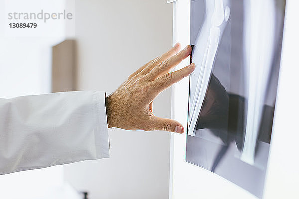 Nahaufnahme eines Arztes  der das Röntgenbild in einer medizinischen Klinik berührt