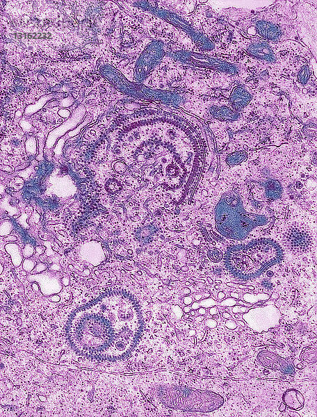 TEM des Virus der Östlichen Pferdeenzephalitis (EEE)