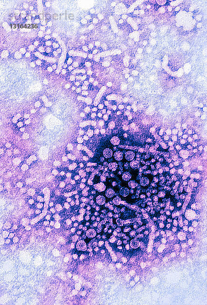 Elektronenmikroskopische Aufnahme  Hepatitis-B-Virus