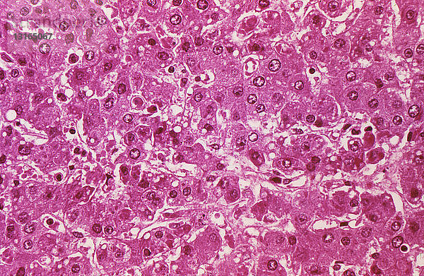 Lichtmikroskopische Aufnahme von Leberzellen mit Ebola-Virus