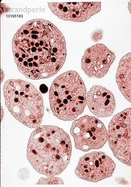 TEM-Bild von menschlichen Blutplättchen