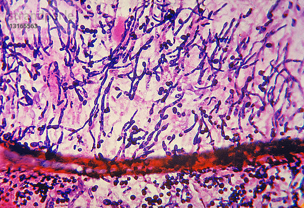 Lichtmikroskopische Aufnahme von Candida-Pilz