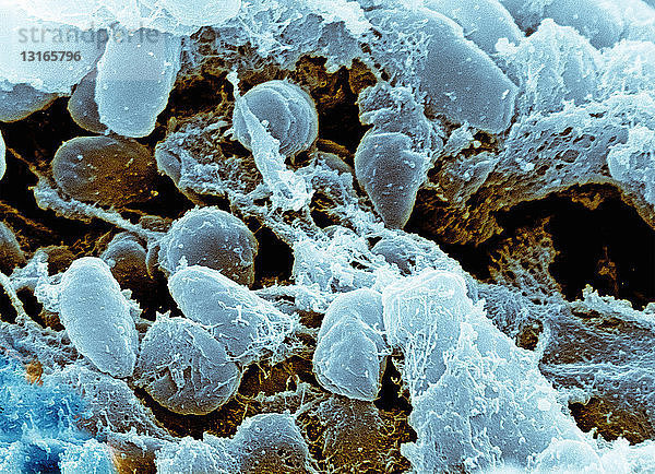SEM  Bild des Bakteriums Yersinia pestis