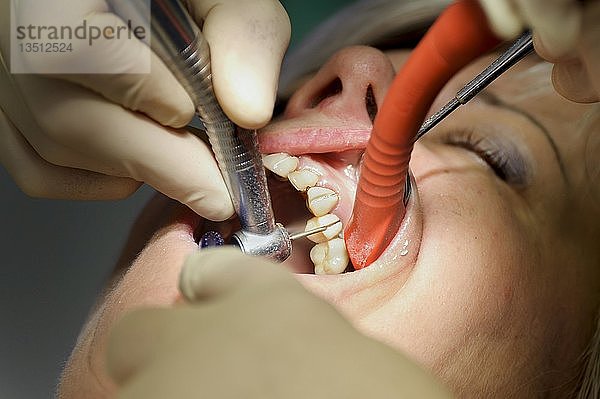Zahnarzt entfernt Zahnkronen