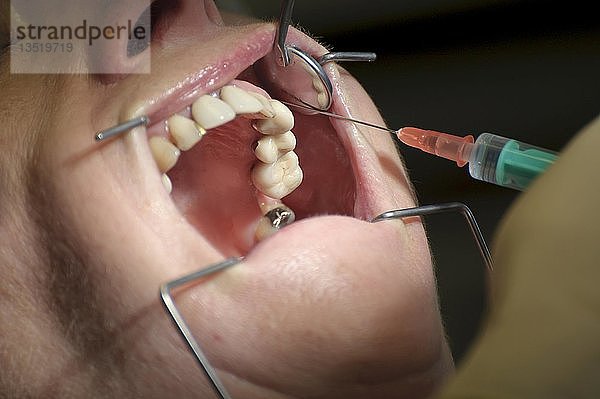 Zahnbehandlung  Nahaufnahme