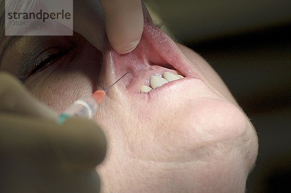 Zahnbehandlung  Nahaufnahme