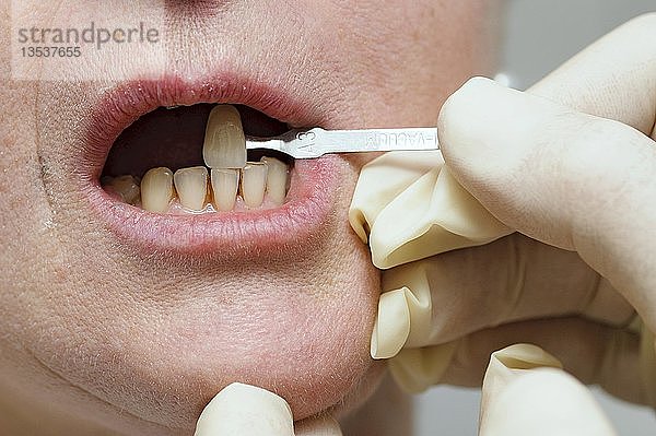 Farbliche Anpassung der Zähne eines Patienten während einer Zahnbehandlung