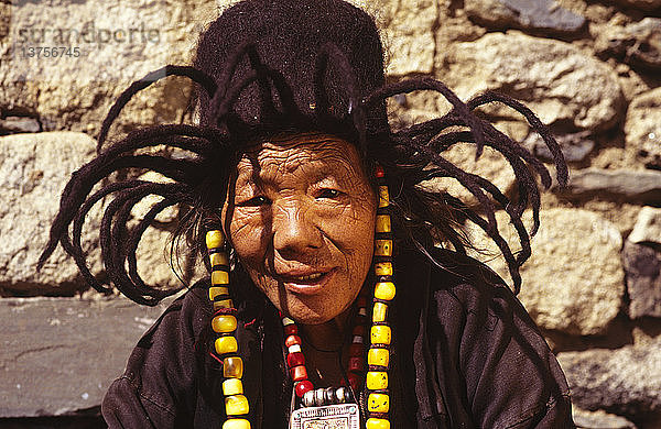 Tashering Pergye Frau aus Mago  mit vernarbtem Gesicht  Bezirk Tawang  Arunachal Pradesh  Indien