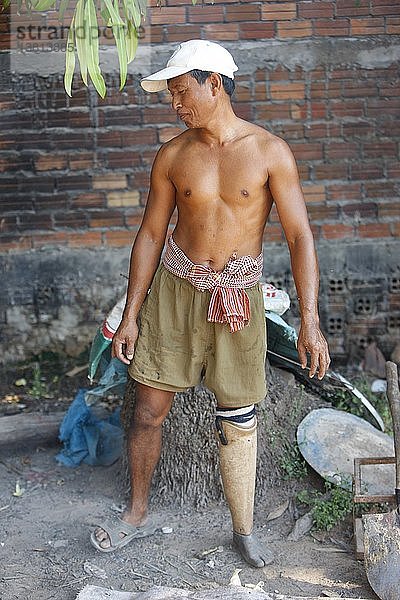 Opfer einer Landmine in Kambodscha  Siem Reap  Kambodscha.