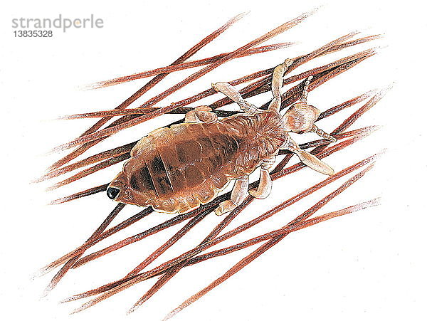 Eine Illustration einer Kopflaus  eines flügellosen Insekts  das auf der menschlichen Kopfhaut lebt.