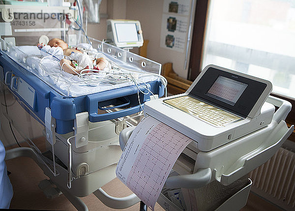 Reportage aus der Neonatologie der Stufe 2 in einem Krankenhaus in Haute-Savoie  Frankreich. Bei einem Neugeborenen mit Herzrhythmusstörungen wird ein EKG gemacht.