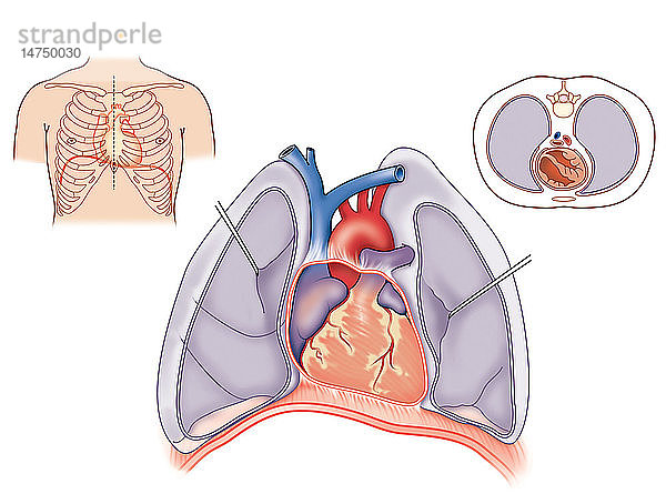 HERZ  ILLUSTRATION - Das Herz ist mit dem Zwerchfell  dem Brustbein und den großen Blutgefäßen durch faseriges Gewebe aus seiner Hülle  dem Herzbeutel (Perikard)  verbunden.